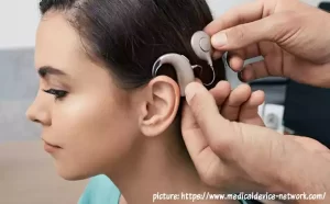 Lees meer over het artikel 1e onderzoek wereldwijd naar cochleair implantaat bij tinnitus